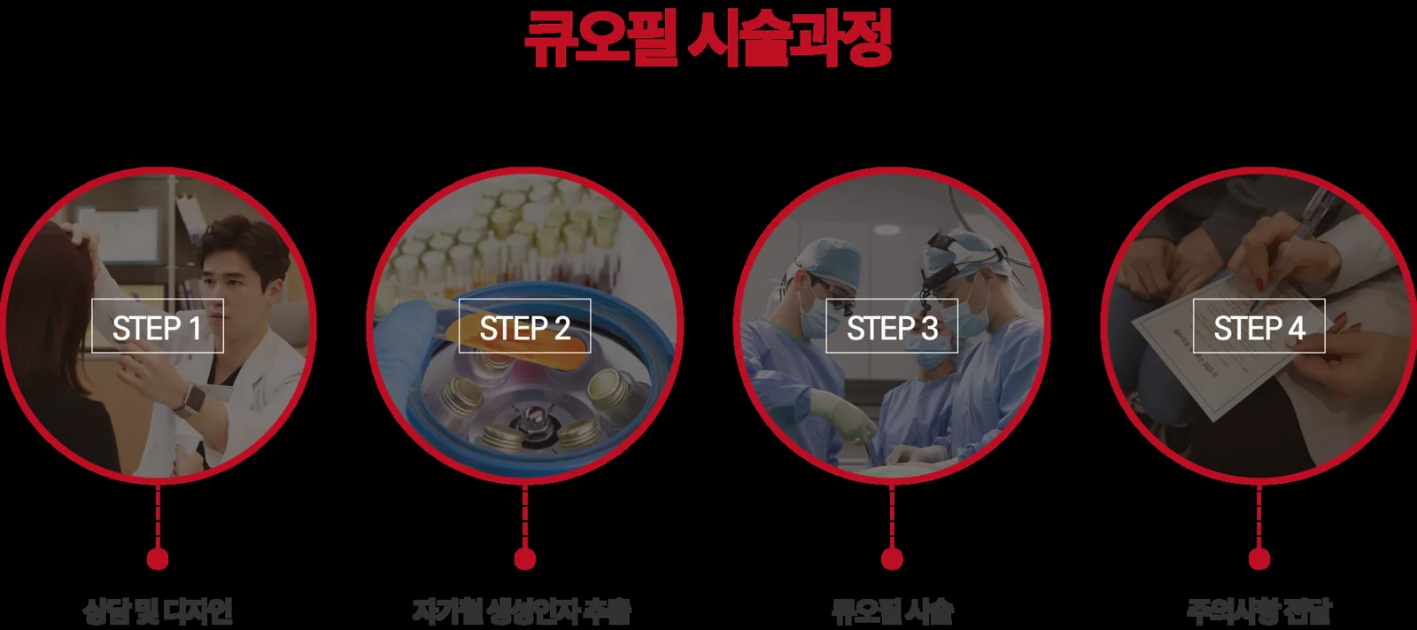 큐오필