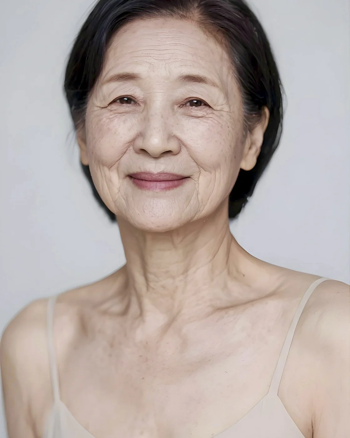 중등도 이상의 노화로 근본적인 리프팅이 필요한 경우