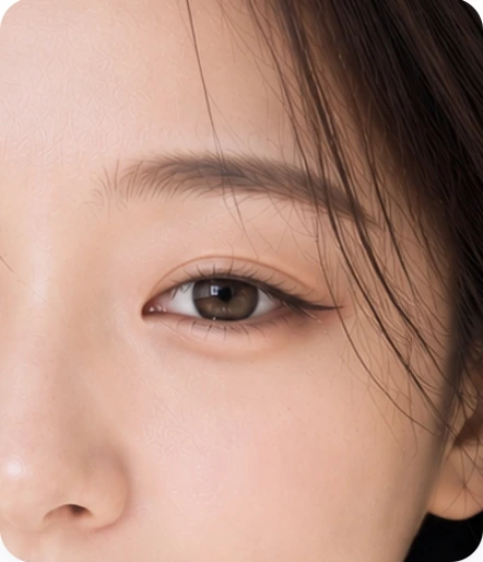 แก้ไขความหย่อนคล้อยของใบหน้าส่วนบน — ดวงตาและหางตาที่ตก