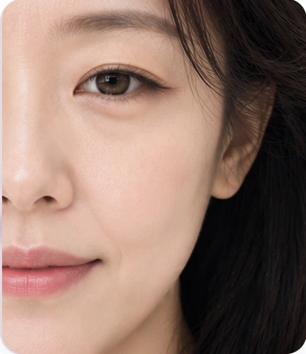 แก้ไขความหย่อนคล้อยใบหน้าส่วนกลาง — แก้มด้านหน้าหย่อน, ร่องแก้ม
