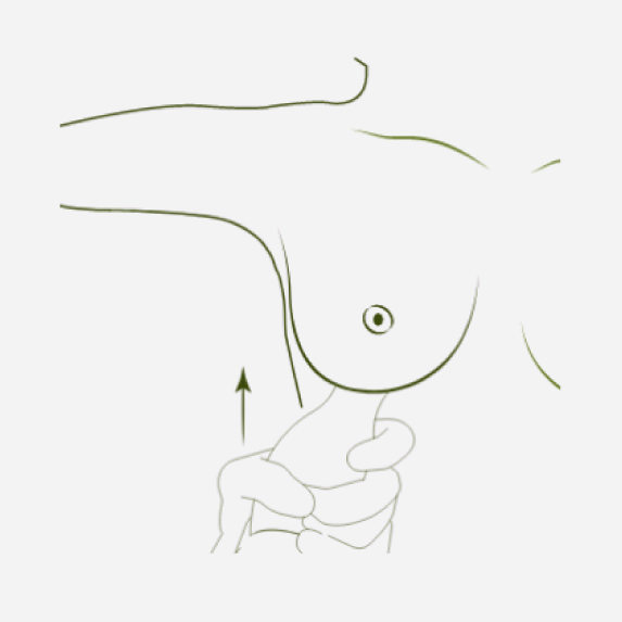 Implant Insertion and Suturing Diagram