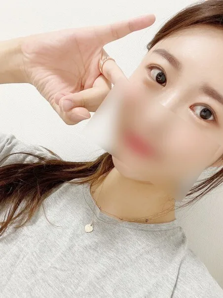 香腸眼修復手術分享